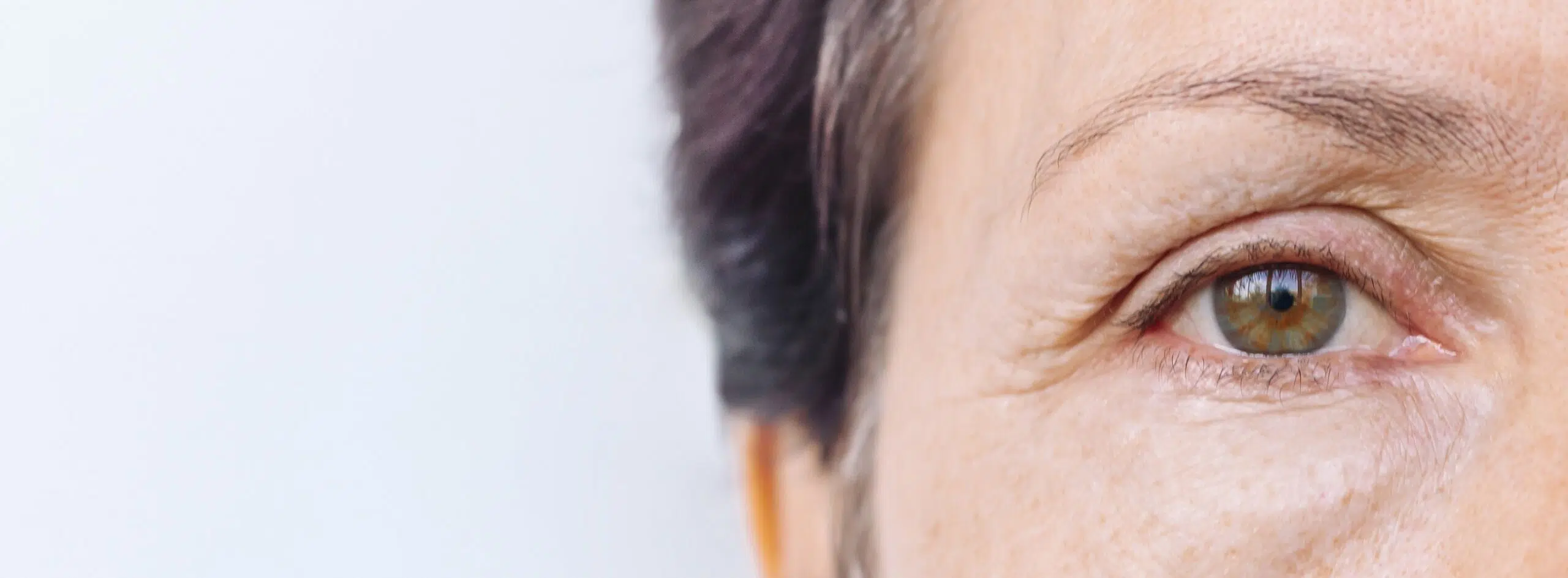 La blépharoplastie va-t-elle modifier ma vision ? |Dr Christophe Reinbold | Lyon