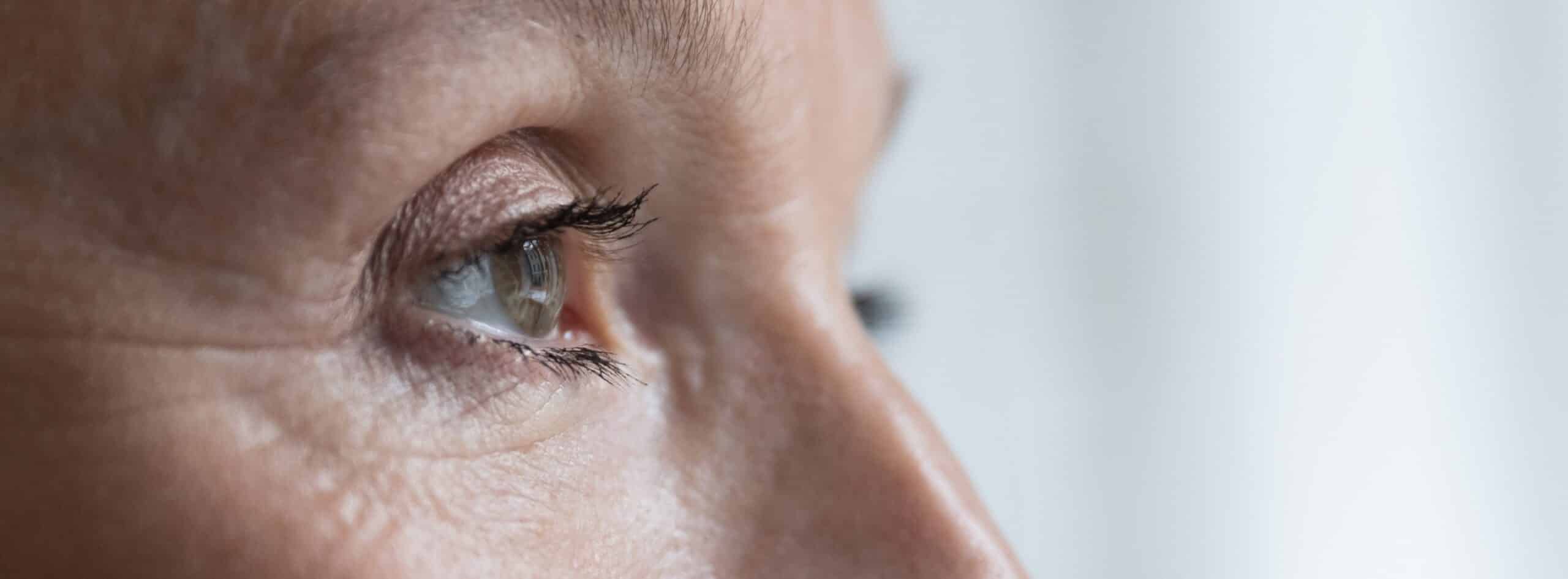 Vue rapprochee sur l oeil d un homme de profile droit la blepharoplastie pour qui pour quoi | Dr Christophe Reinbold Lyon