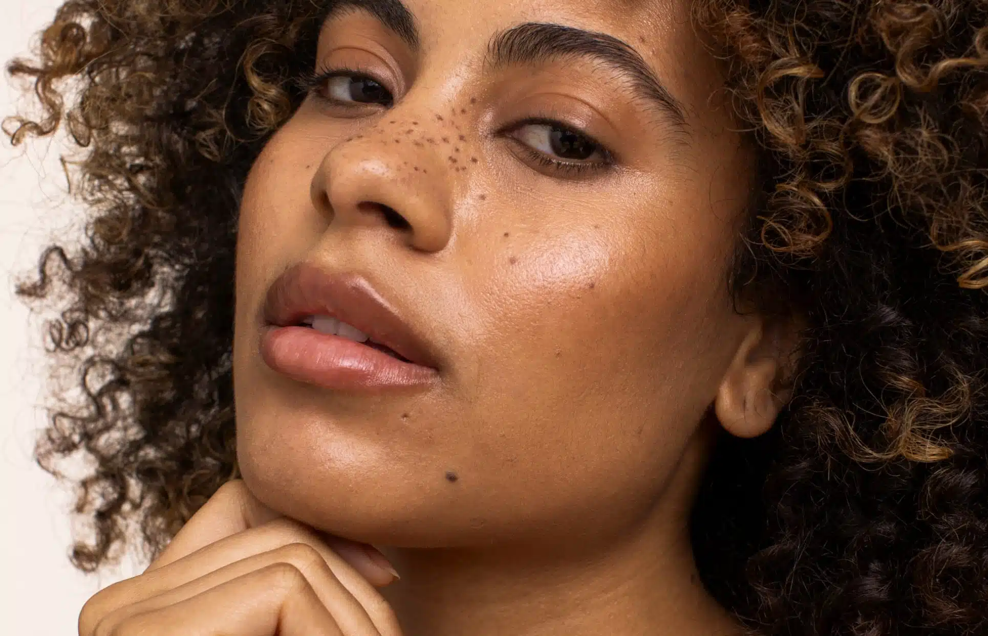 Visage d une femme brune avec des points noir sur le nez genoplastie medicale | Dr Christophe Reinbold Lyon