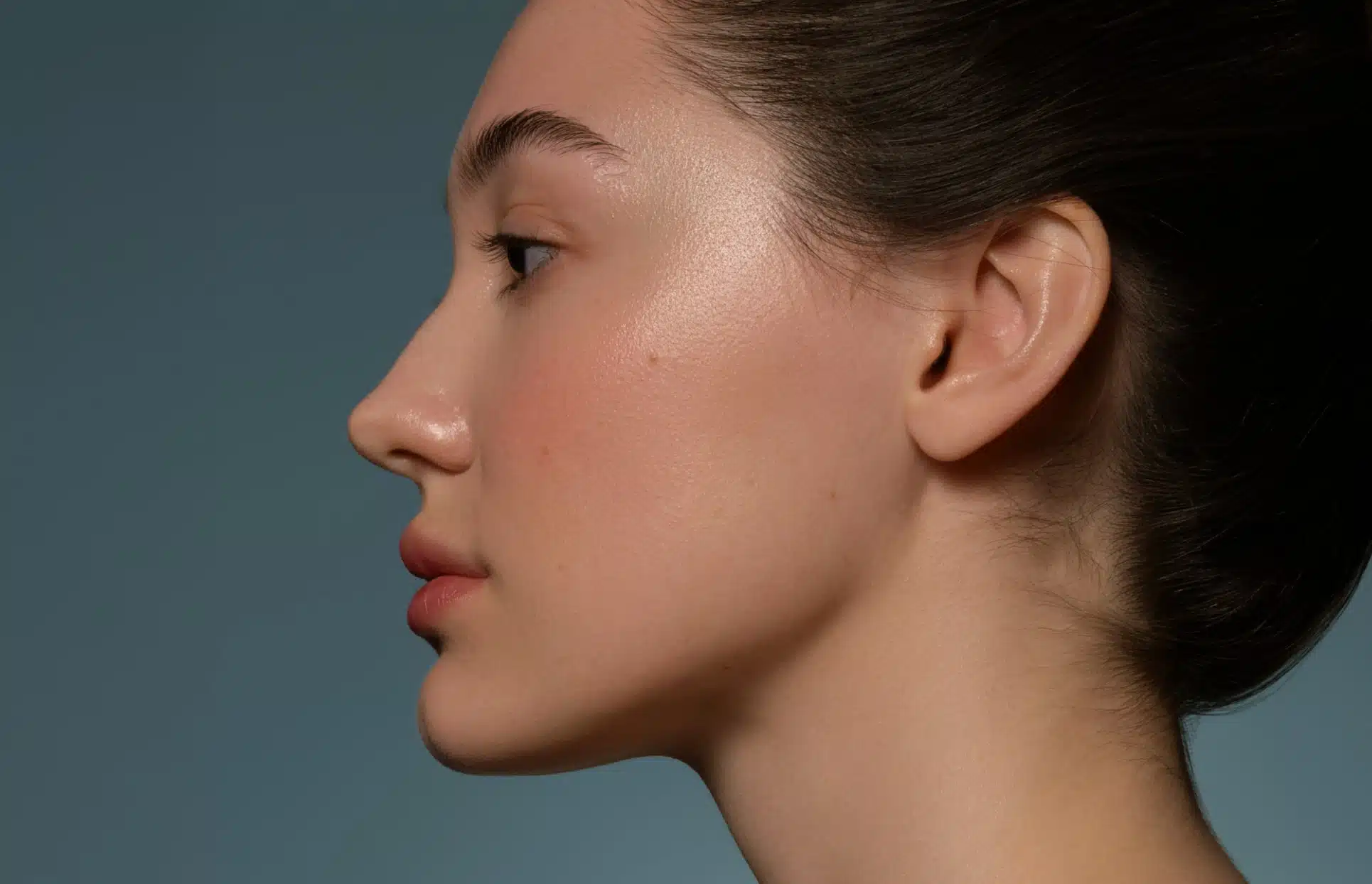 Photo de profil gauche du visage d une jeune femme rhinoplastie medicale | Dr Christophe Reinbold Lyon