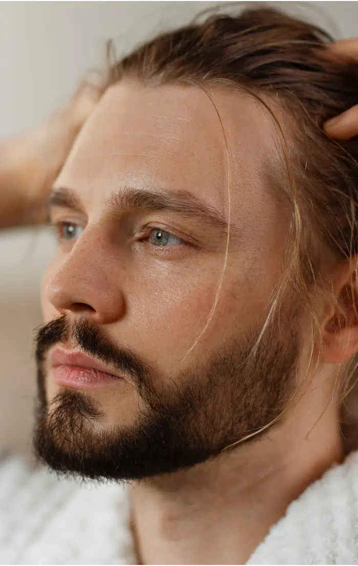 Visage d un jeune homme barbu avec cheveux long la microgreffe des cheveux fue | Dr Christophe Reinbold Lyon