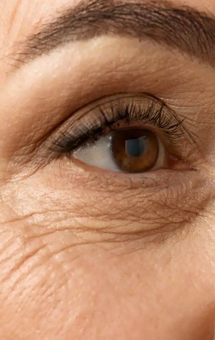 Photo rapprochee d un oeil d une femme blepharoplastie inferieure| Dr Christophe Reinbold Lyon