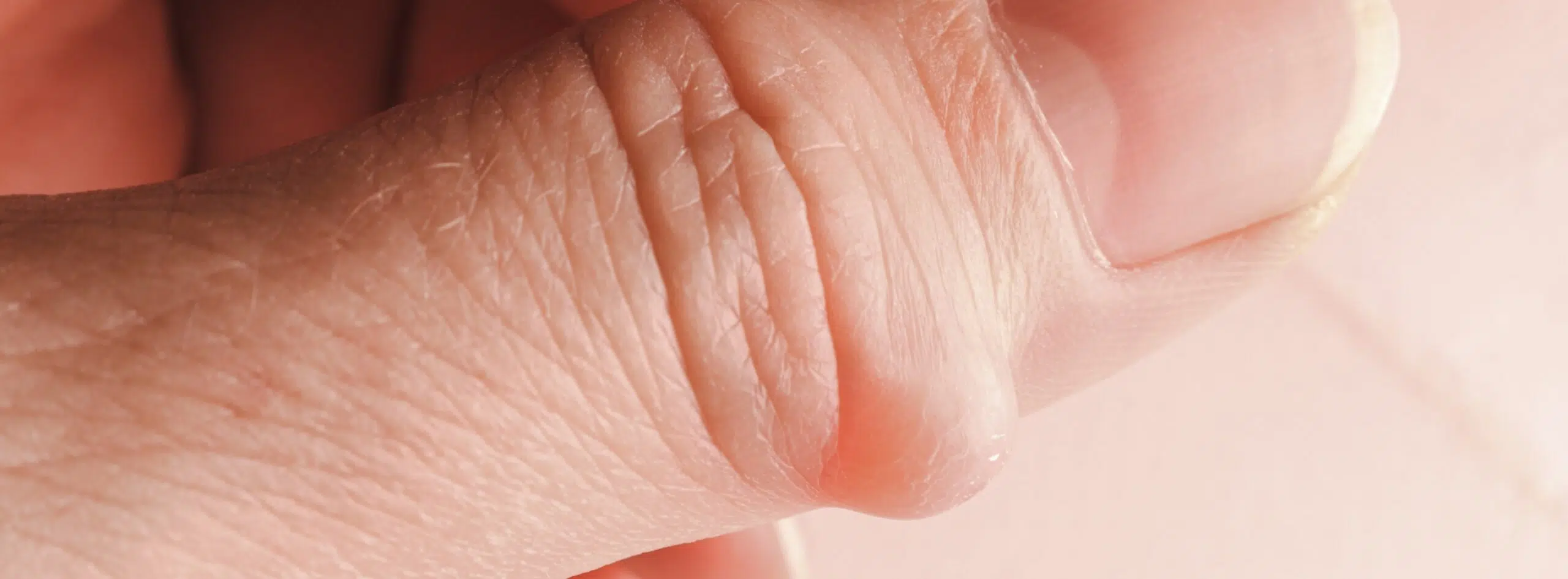 Lipome ou kyste